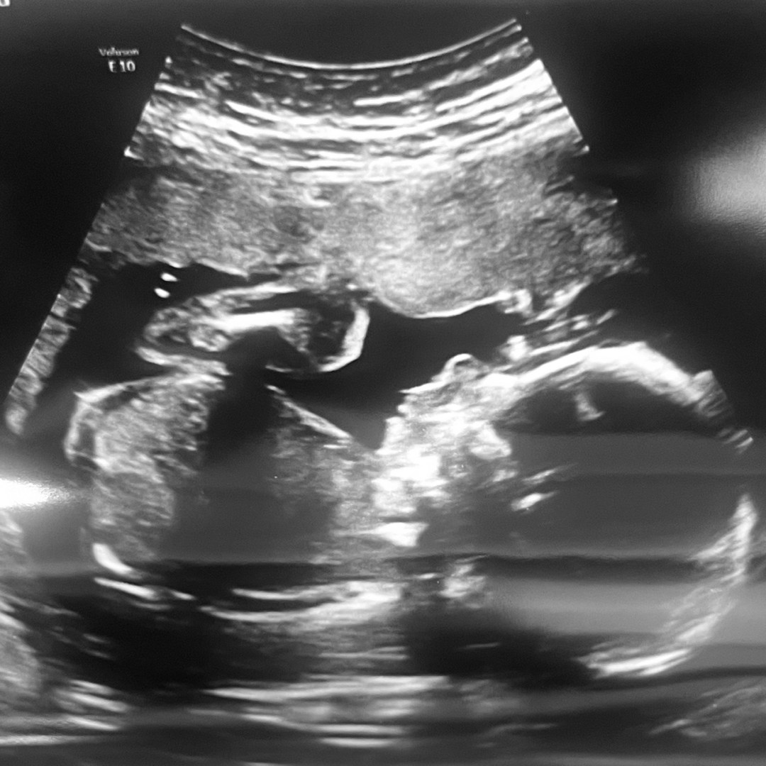 Photo shared by Adrianna for their Babylist baby registry.