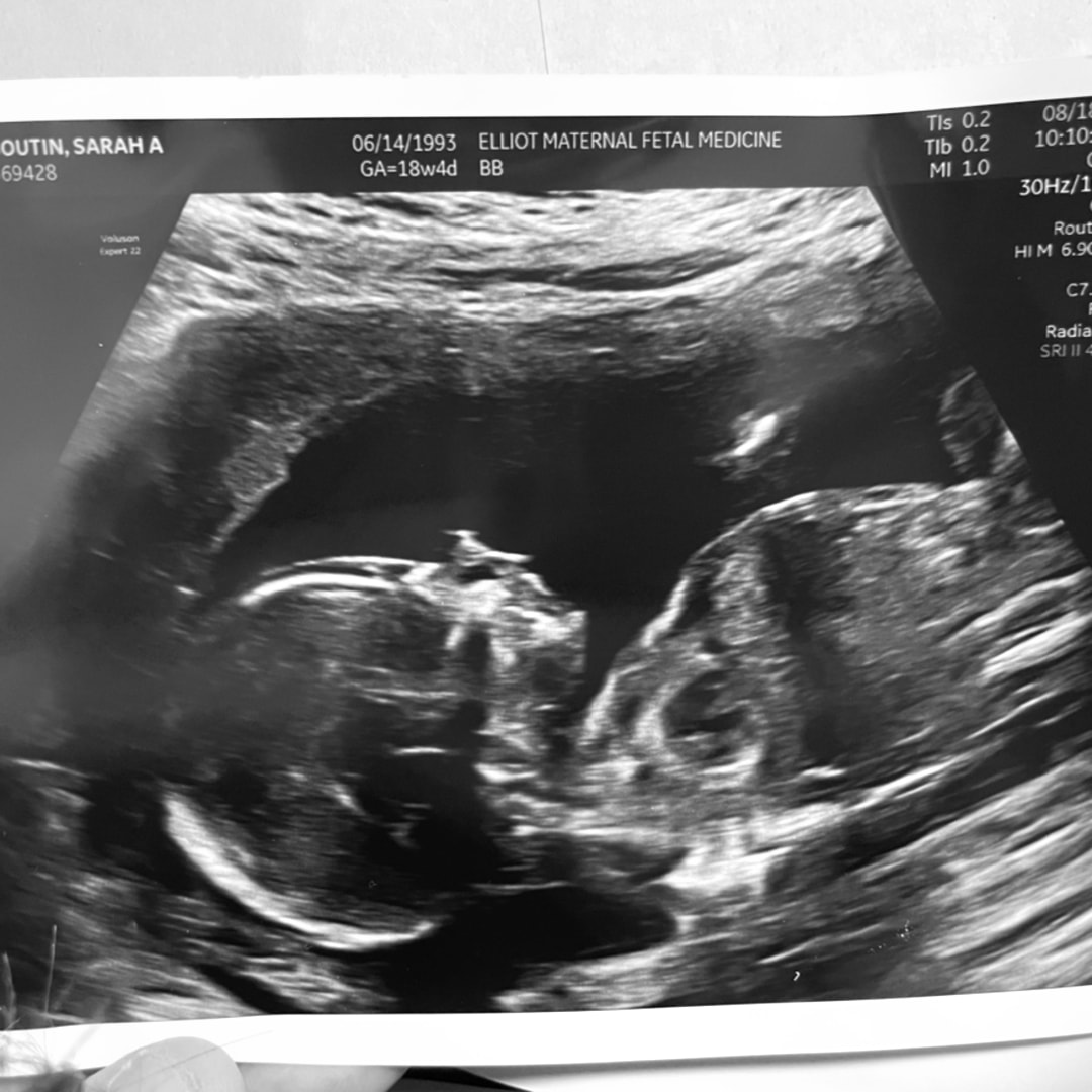 Photo shared by Sarah for their Babylist baby registry.