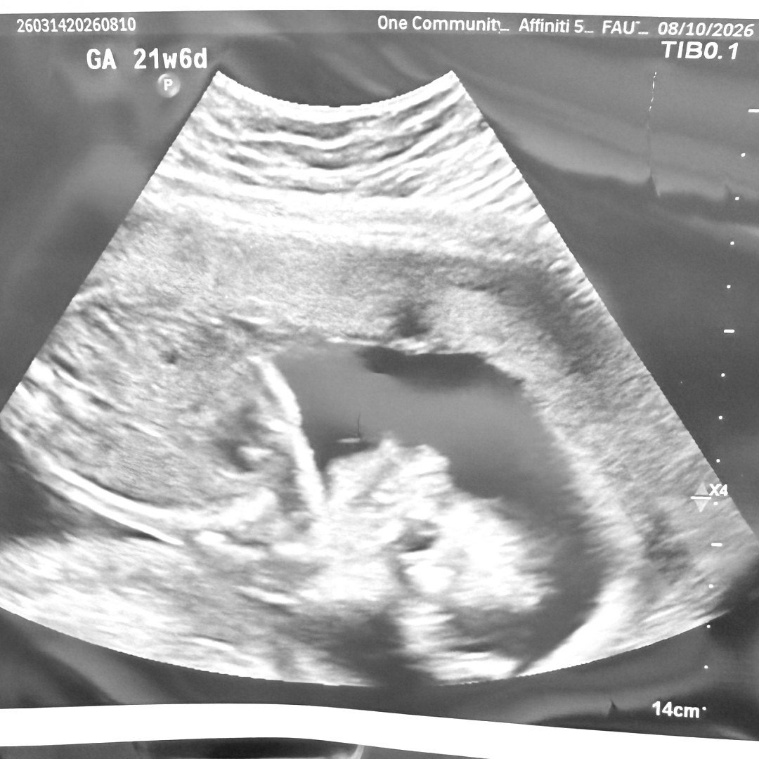 Photo shared by Katlyn for their Babylist baby registry.