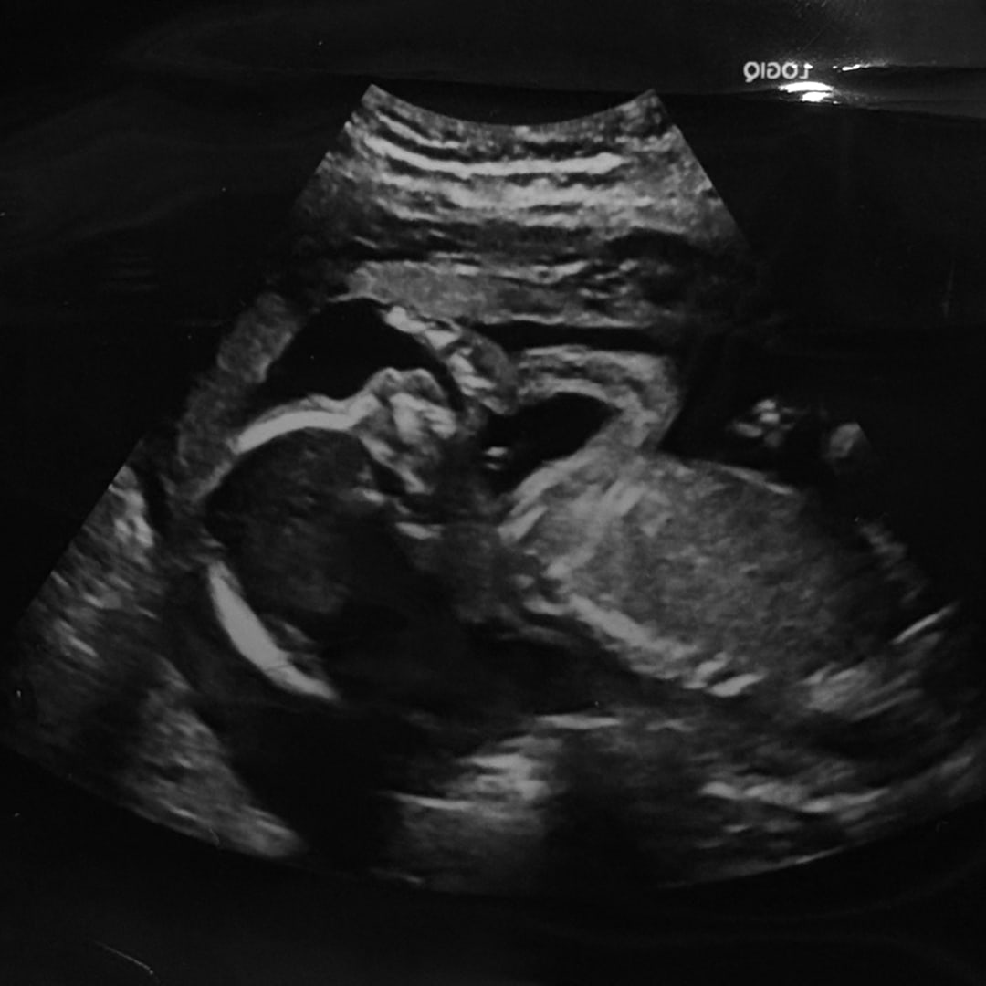 Photo shared by Ashley for their Babylist baby registry.