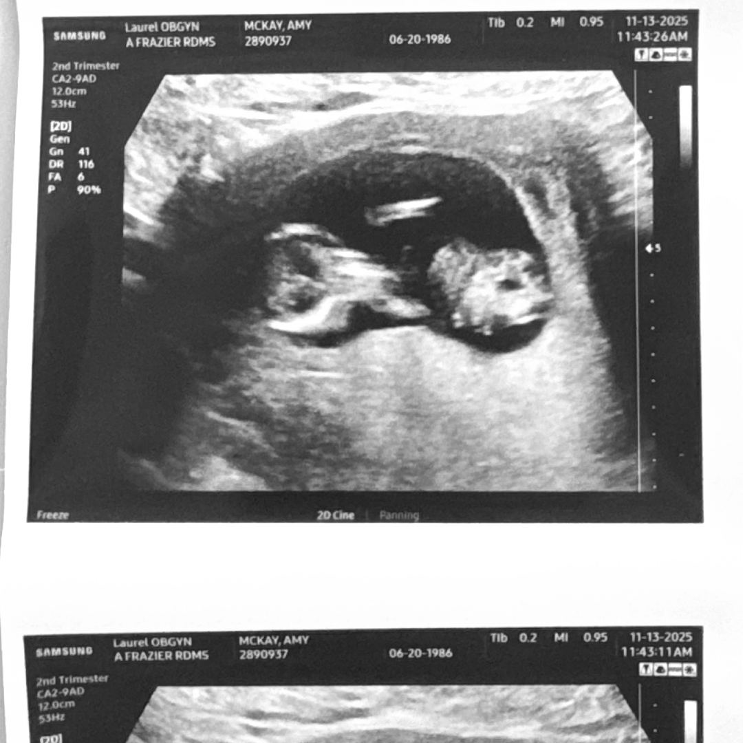 Photo shared by Amy for their Babylist baby registry.