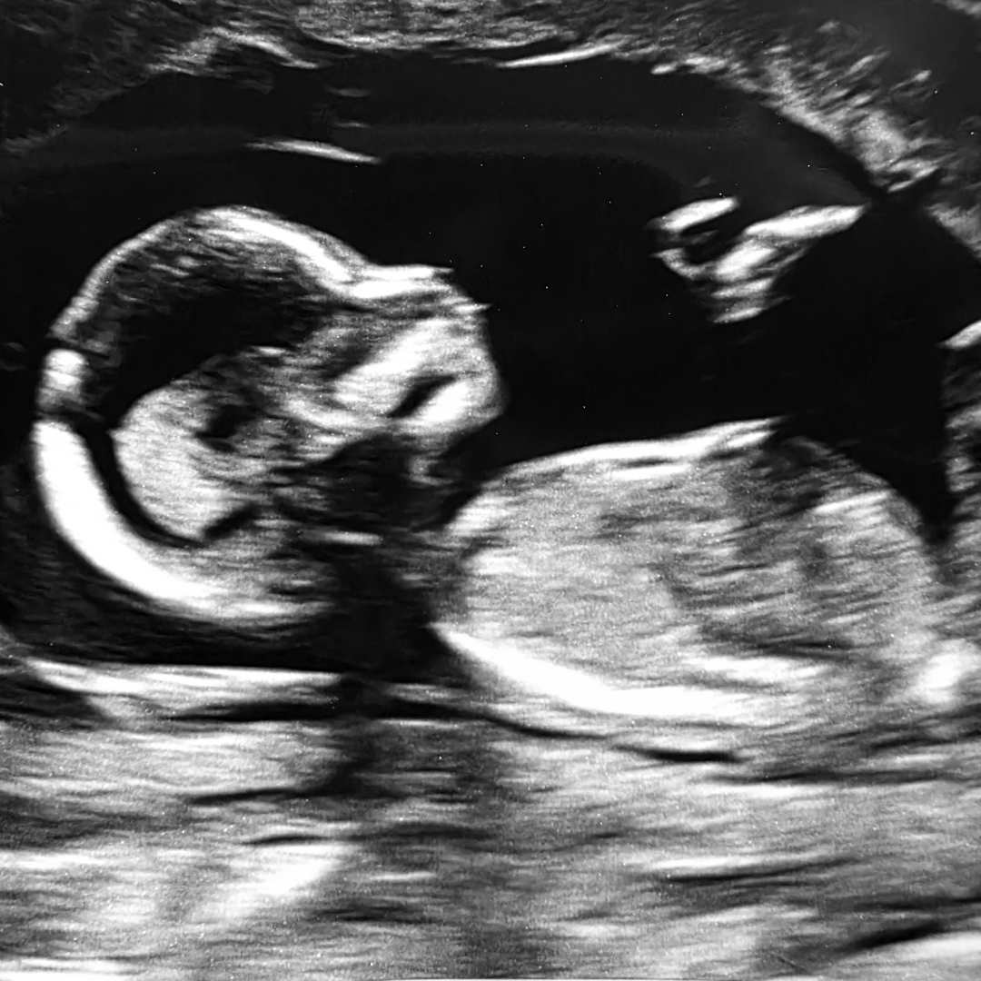 Photo shared by Cassandra for their Babylist baby registry.