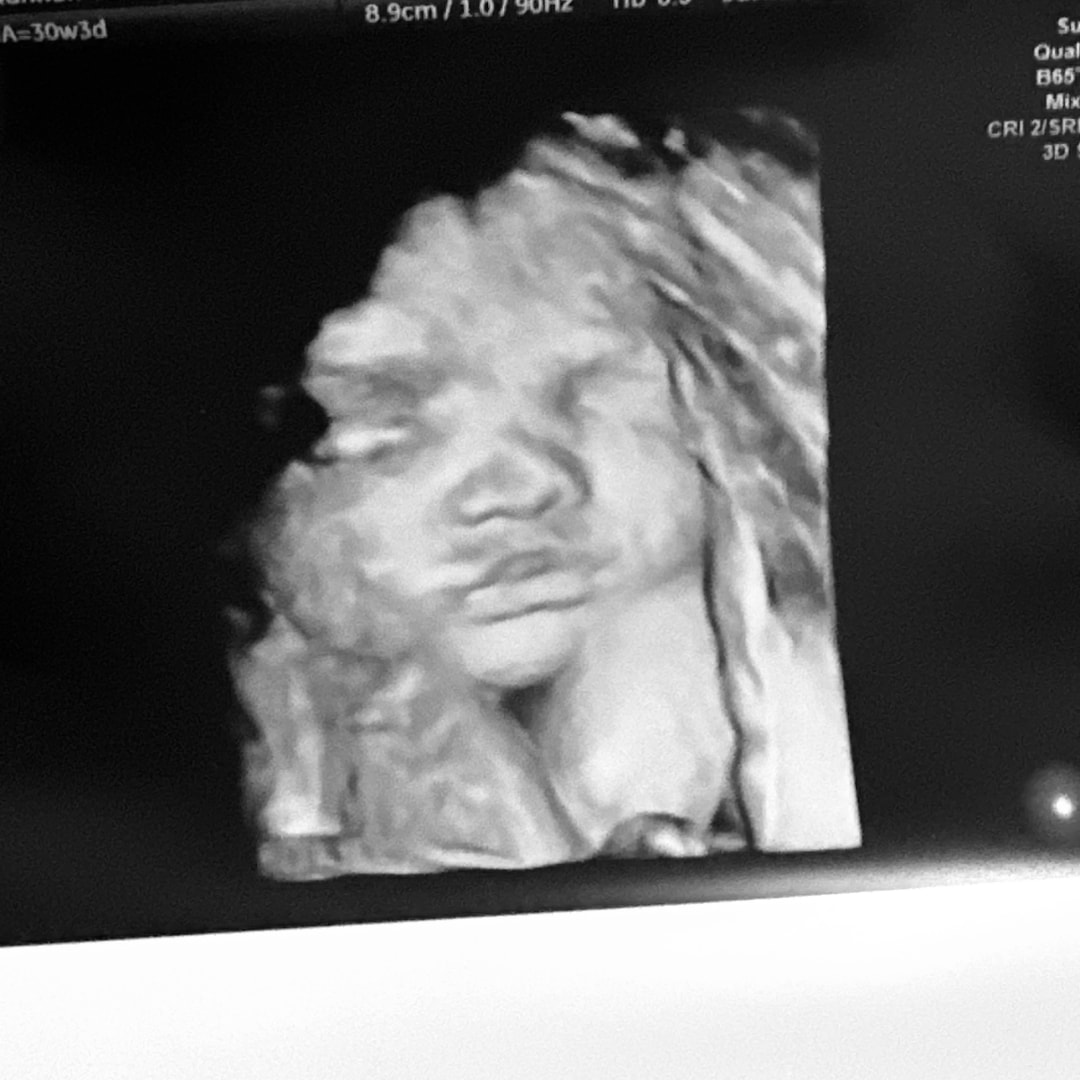 Photo shared by Hannah for their Babylist baby registry.