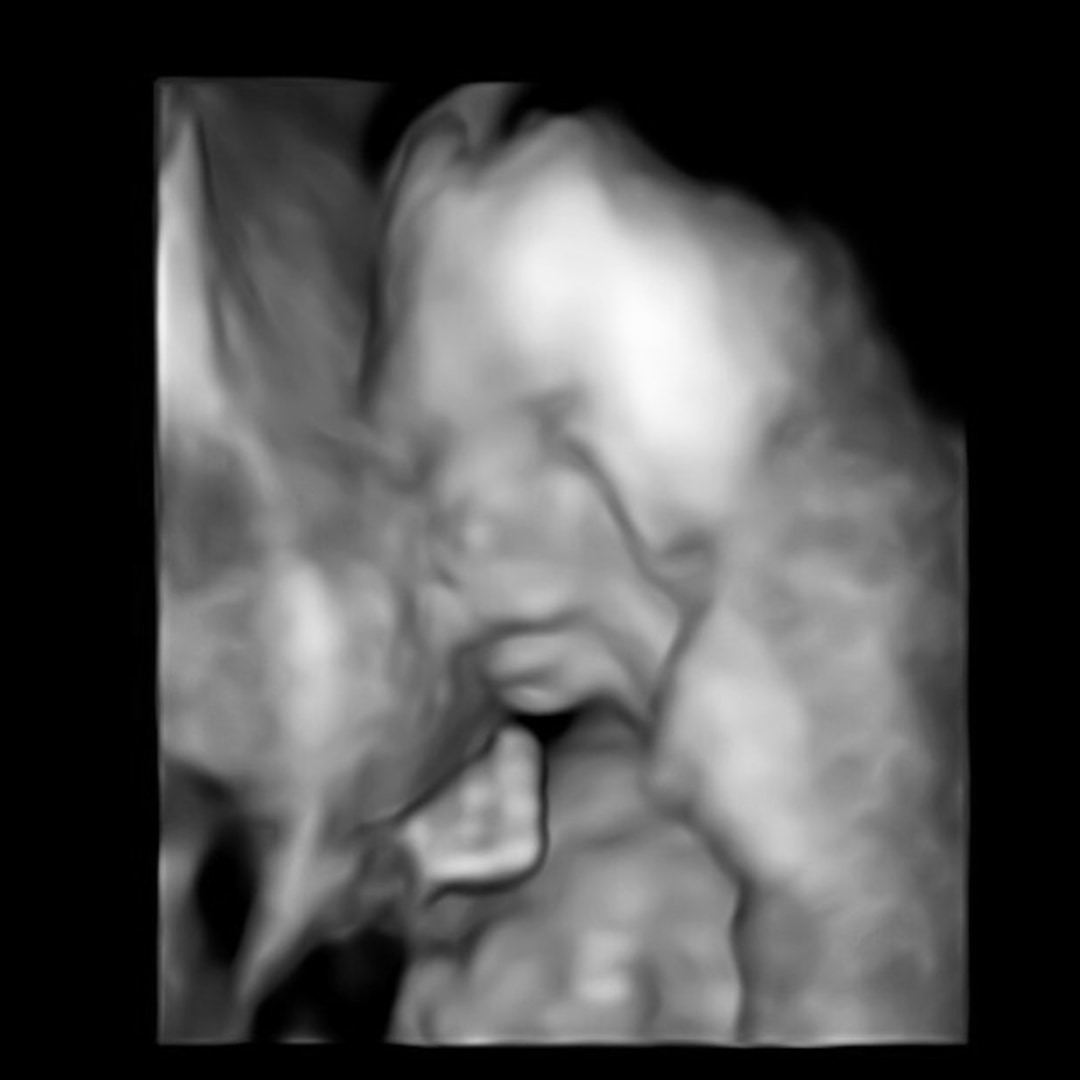 Photo shared by Georgia for their Babylist baby registry.