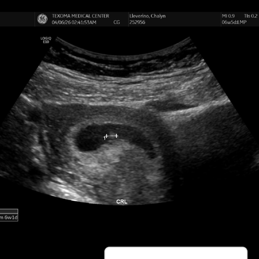 Photo shared by Chalyn for their Babylist baby registry.