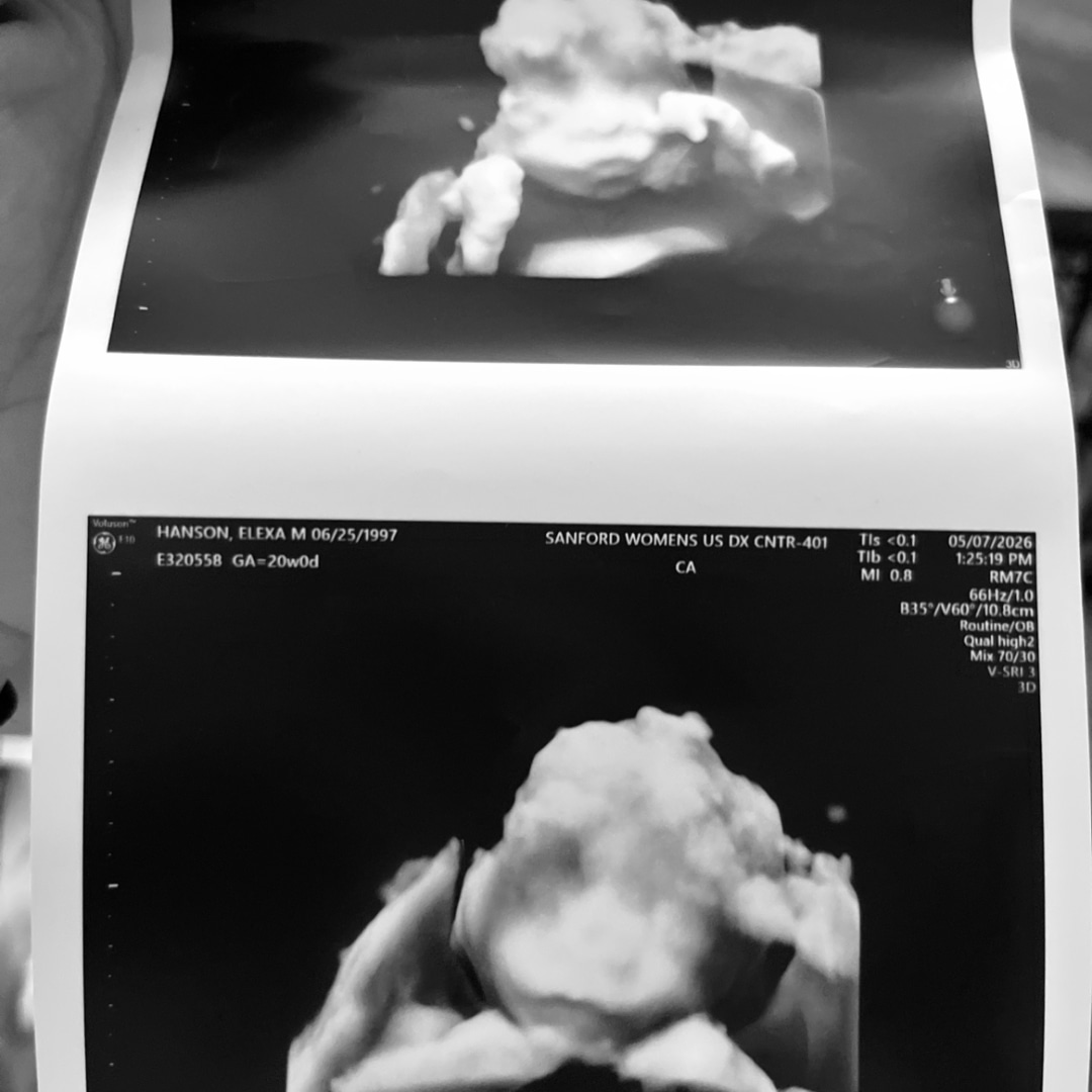 Photo shared by Elexa for their Babylist baby registry.