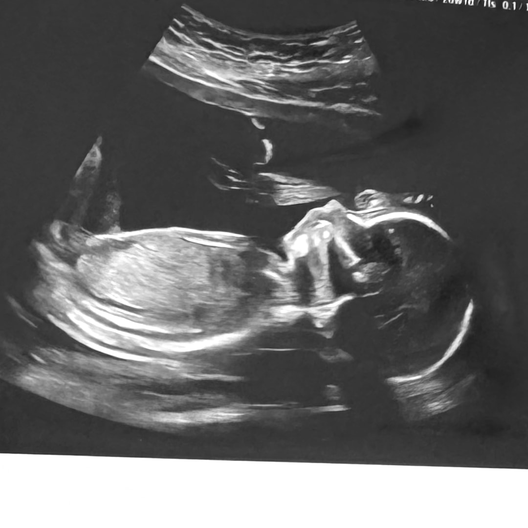 Photo shared by Christina & Sean for their Babylist baby registry.