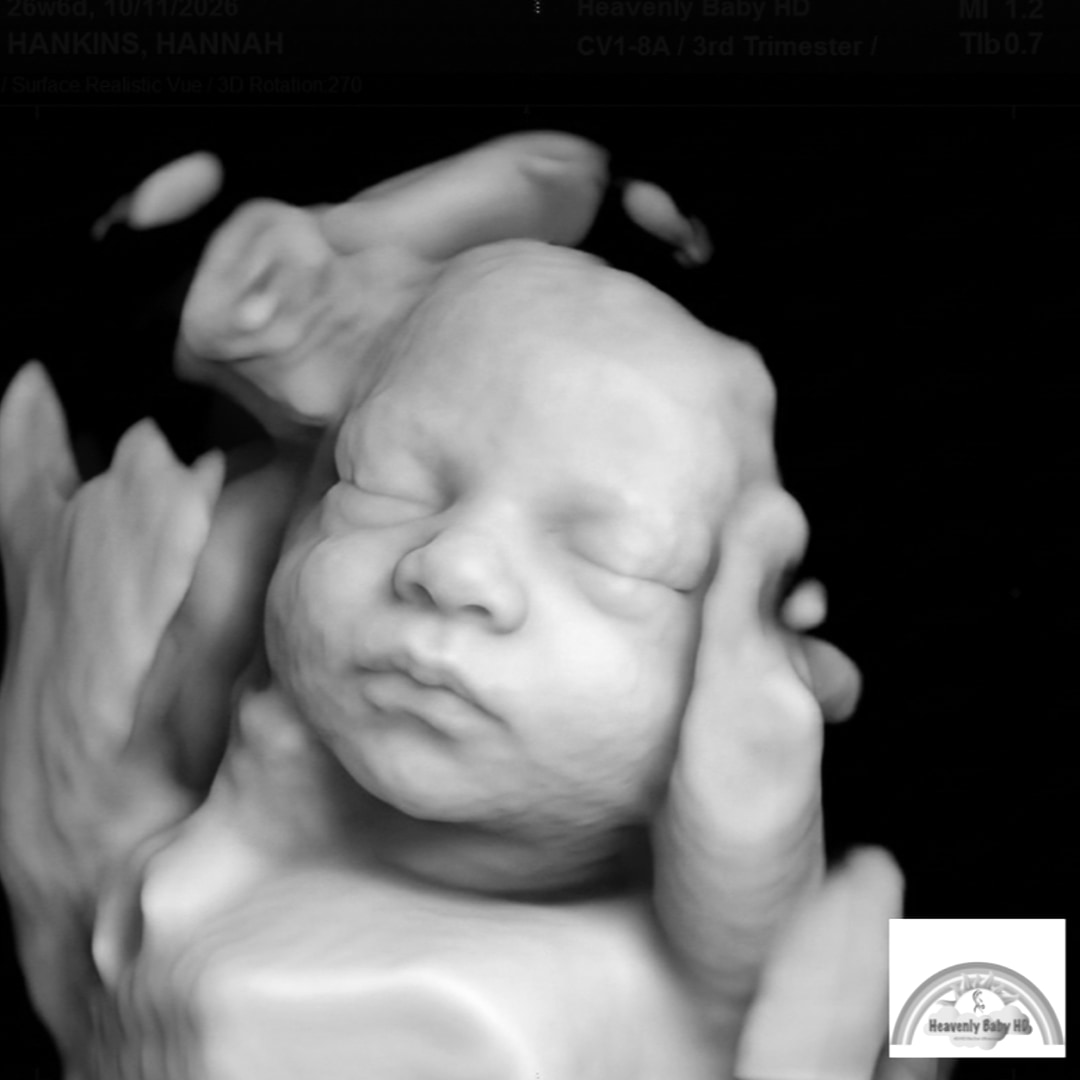 Photo shared by Hannah for their Babylist baby registry.