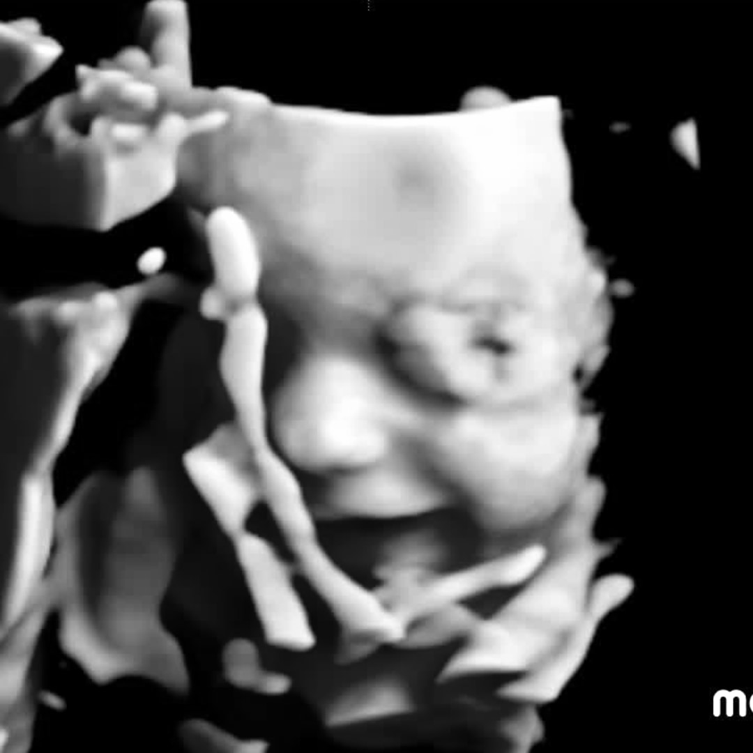 Photo shared by Logann for their Babylist baby registry.