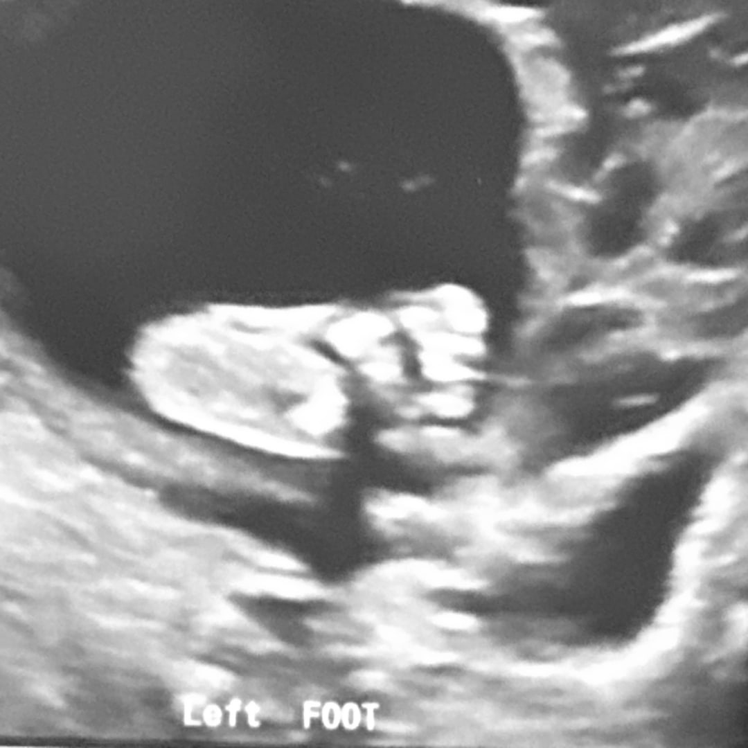 Photo shared by Emma for their Babylist baby registry.