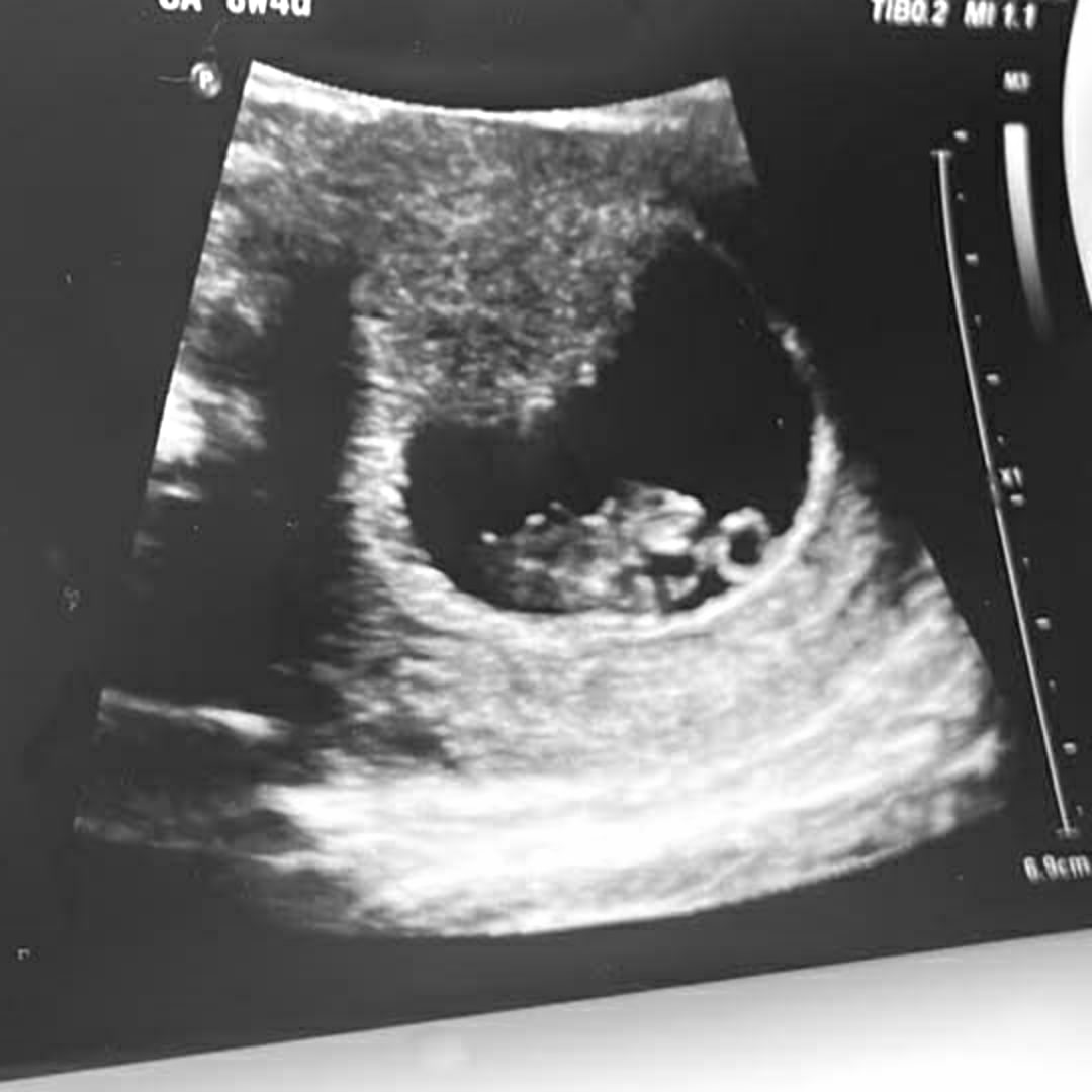 Photo shared by Nicole for their Babylist baby registry.