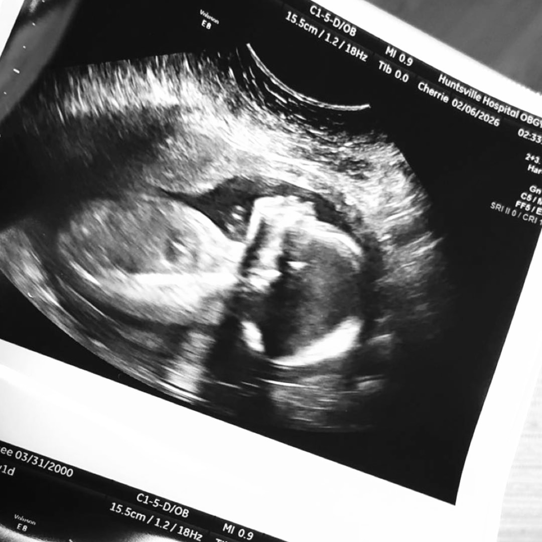 Photo shared by Kaylee for their Babylist baby registry.