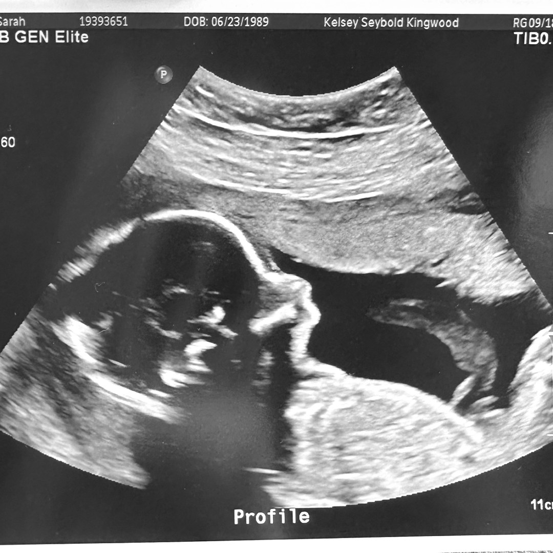 Photo shared by Sarah for their Babylist baby registry.