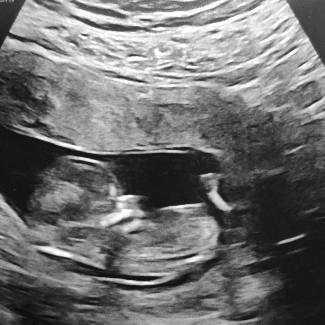 Photo shared by Mikhayla for their Babylist baby registry.