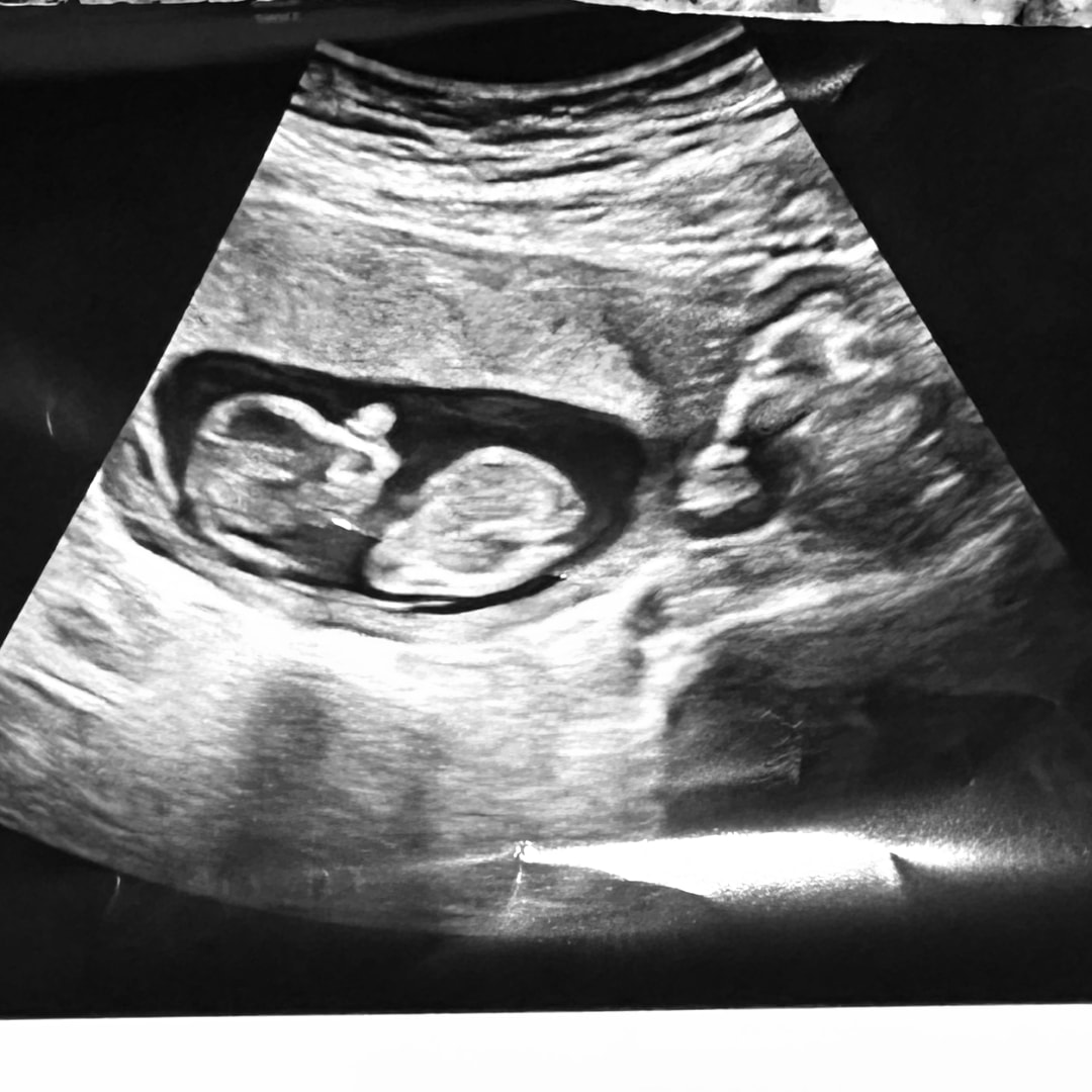 Photo shared by Keara for their Babylist baby registry.