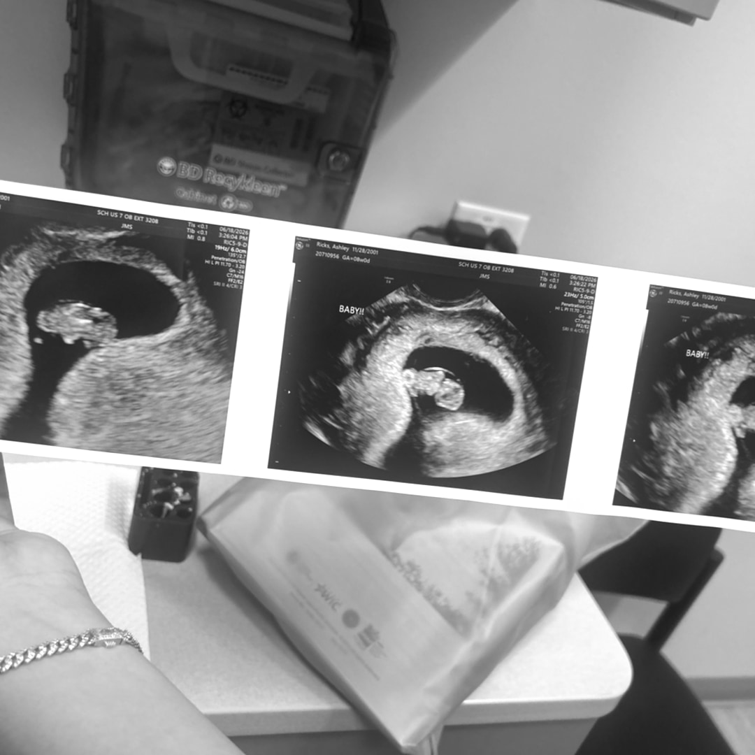 Photo shared by Ashley for their Babylist baby registry.