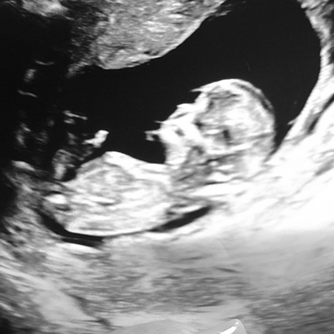 Photo shared by Alexis for their Babylist baby registry.