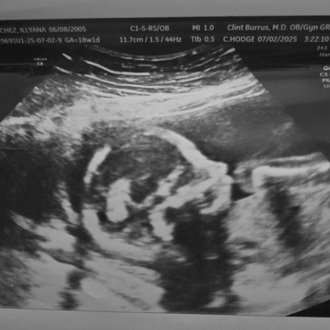 Photo shared by Illyana for their Babylist baby registry.