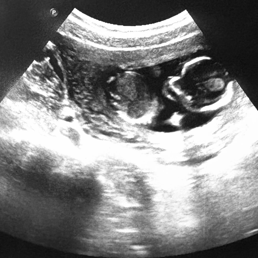 Photo shared by Emma for their Babylist baby registry.