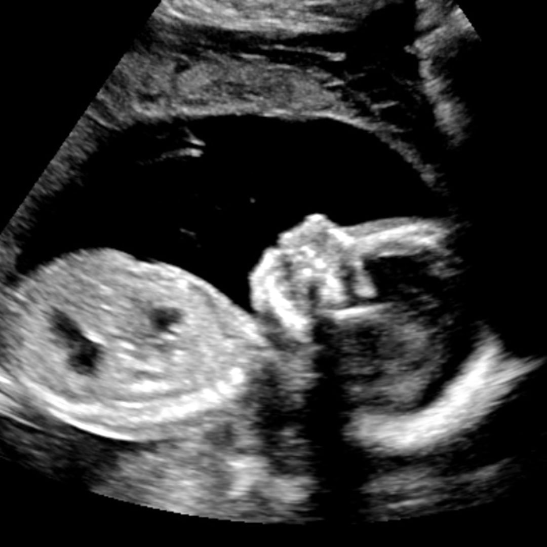 Photo shared by Vanessa for their Babylist baby registry.