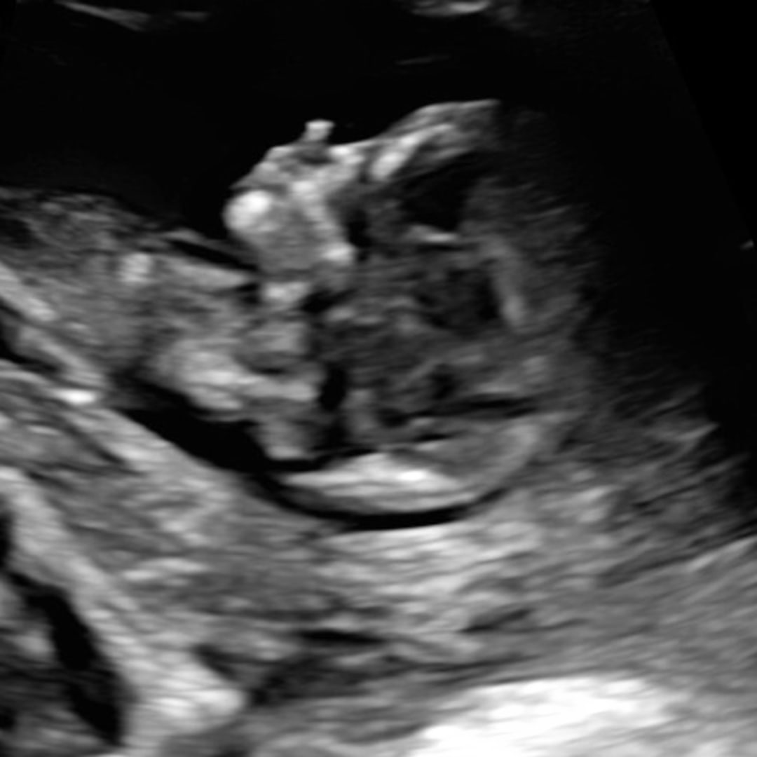 Photo shared by Elizabeth for their Babylist baby registry.