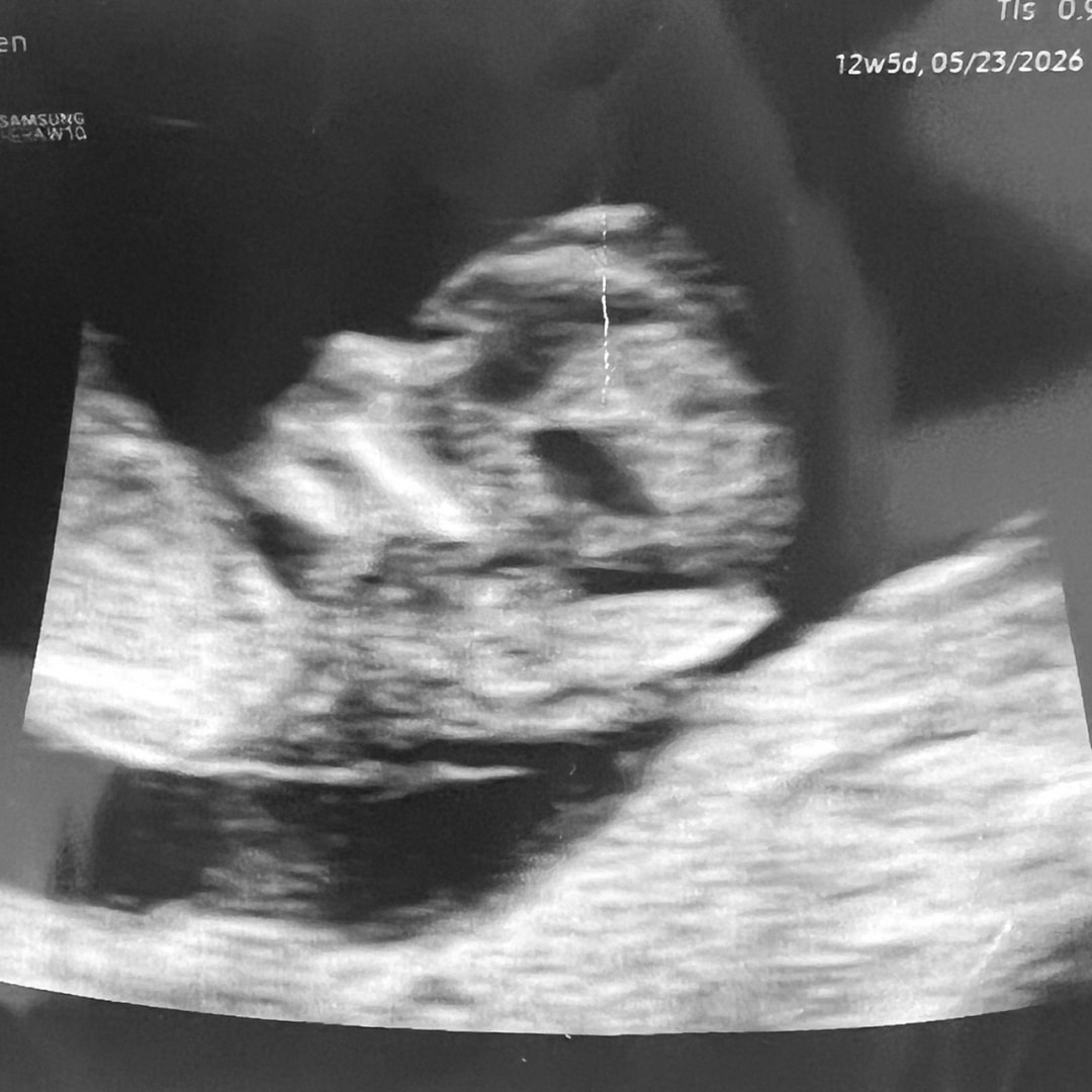 Photo shared by Lauren for their Babylist baby registry.