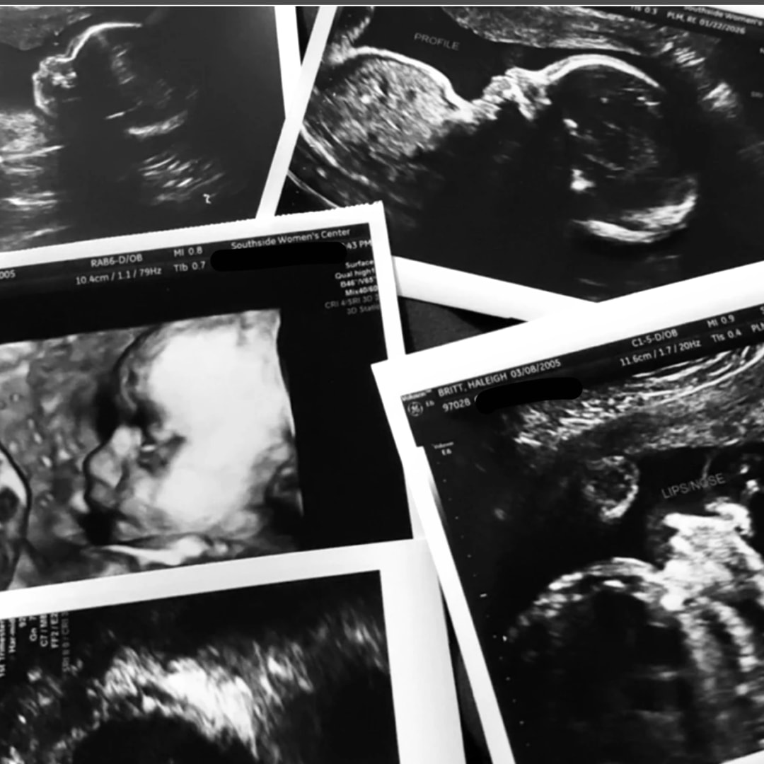 Photo shared by Haleigh for their Babylist baby registry.