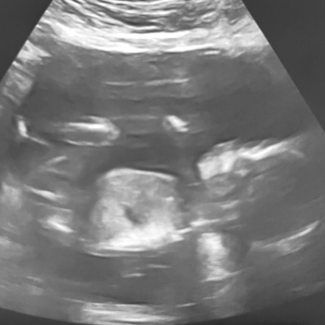 Photo shared by Sylvii for their Babylist baby registry.