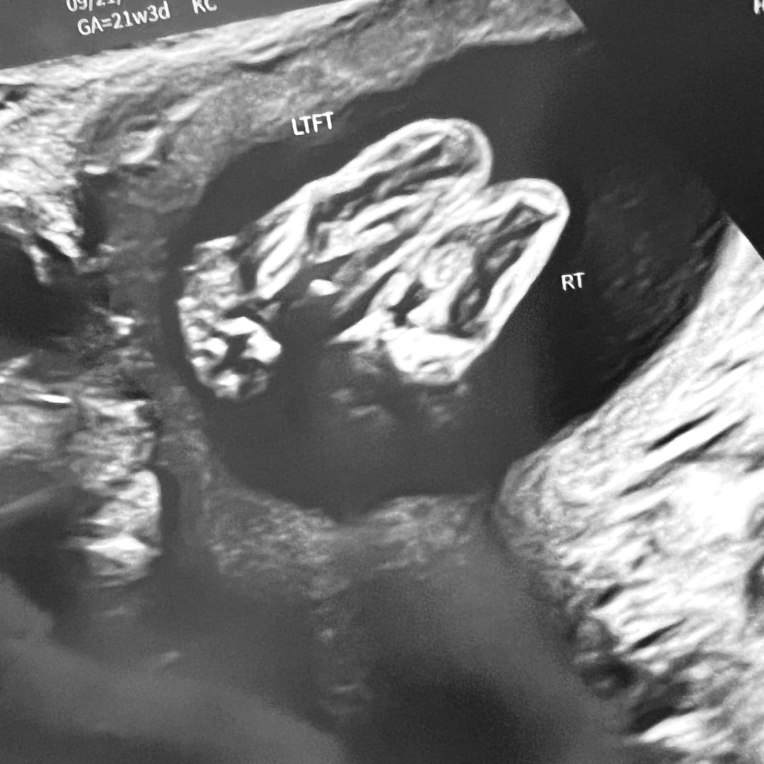 Photo shared by Lauren for their Babylist baby registry.