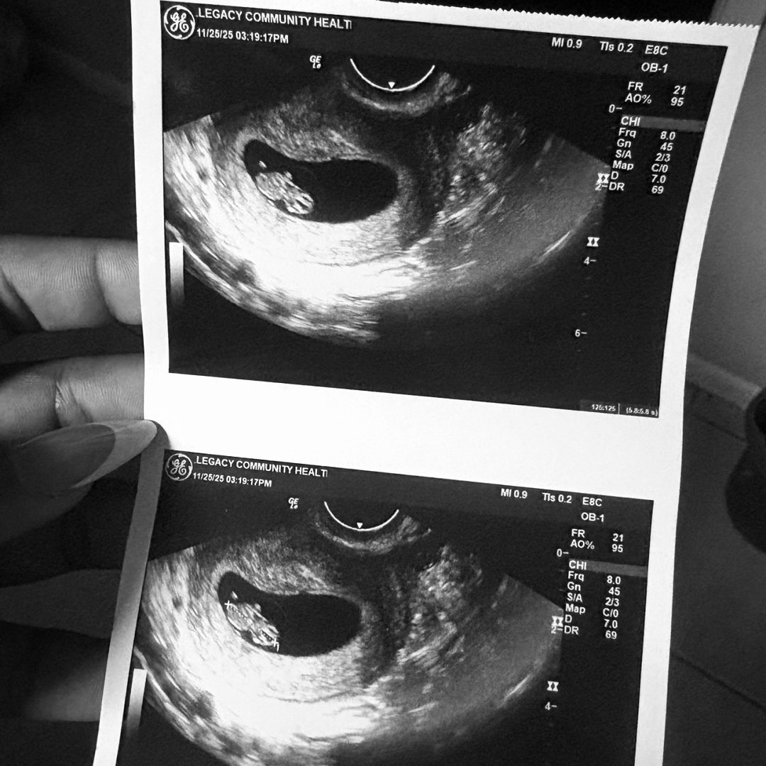 Photo shared by Iriel for their Babylist baby registry.