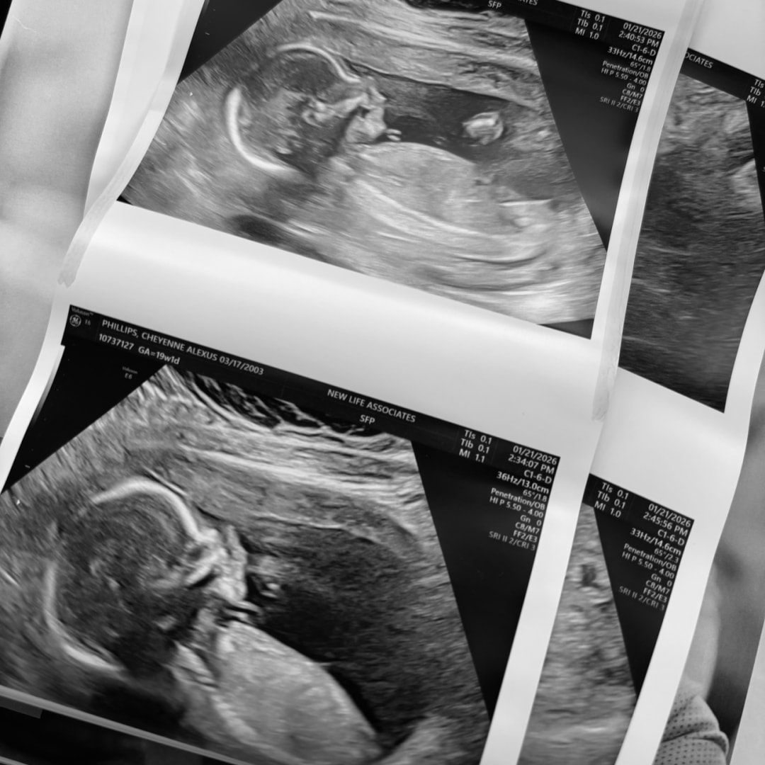 Photo shared by Cheyenne for their Babylist baby registry.