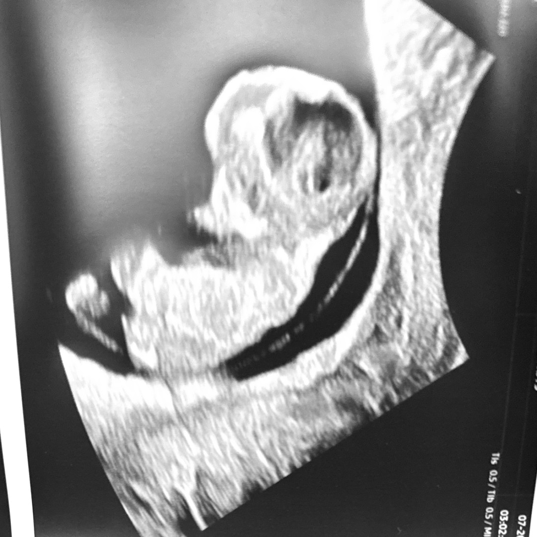 Photo shared by Caitlyn for their Babylist baby registry.