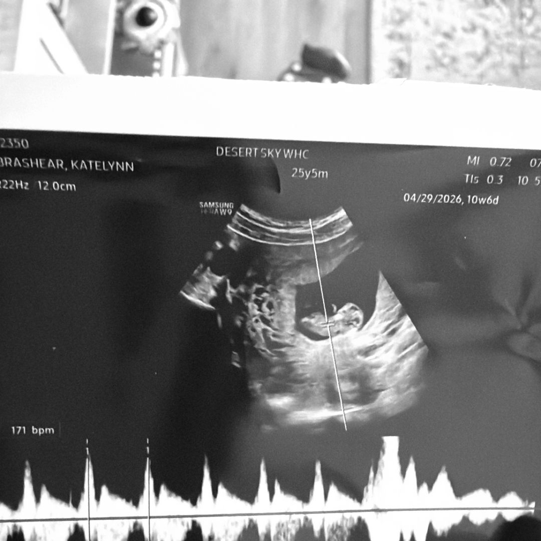 Photo shared by Katelynnn for their Babylist baby registry.