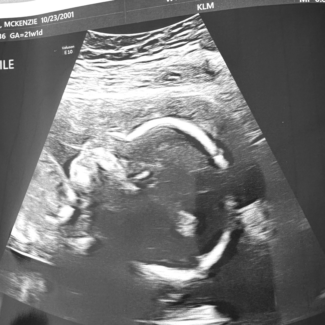 Photo shared by McKenzie for their Babylist baby registry.