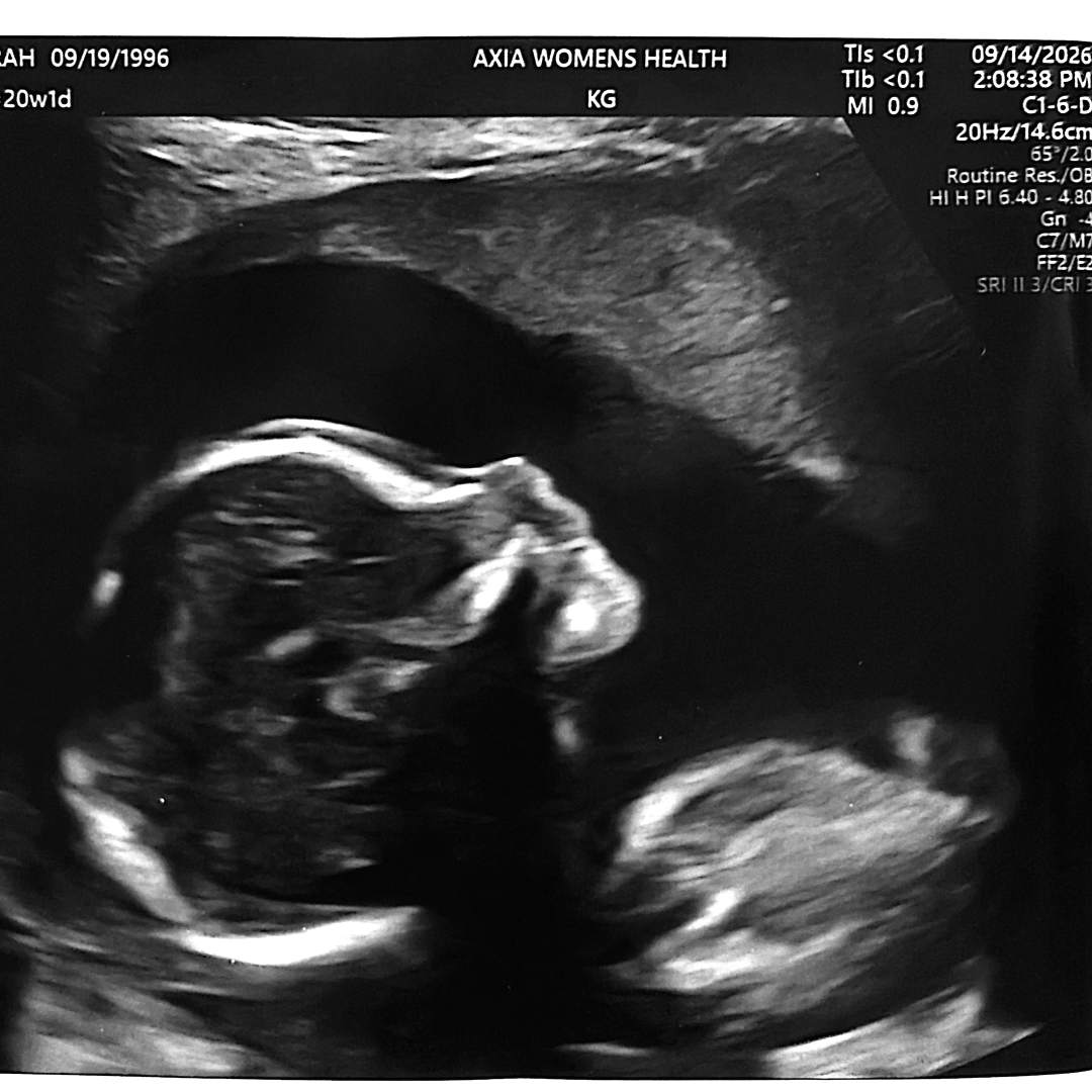Photo shared by Sarah for their Babylist baby registry.