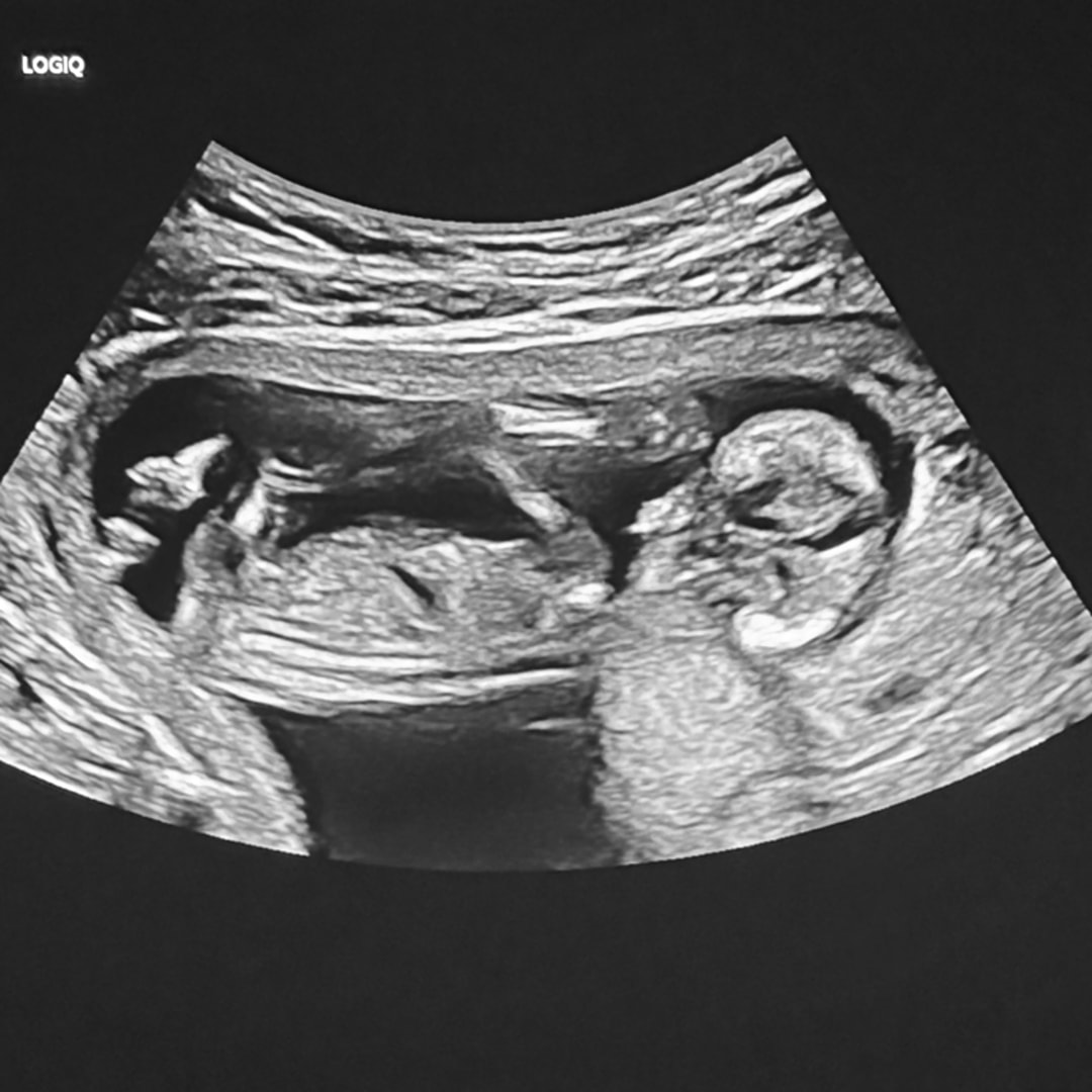 Photo shared by Ariyah for their Babylist baby registry.