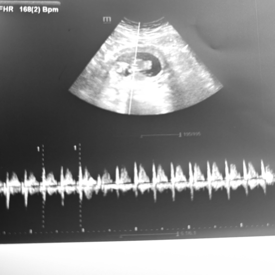 Photo shared by Alizay for their Babylist baby registry.