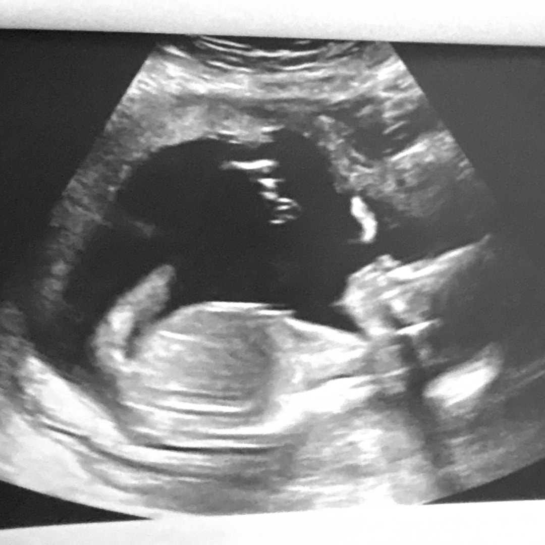 Photo shared by Jacquelyn for their Babylist baby registry.