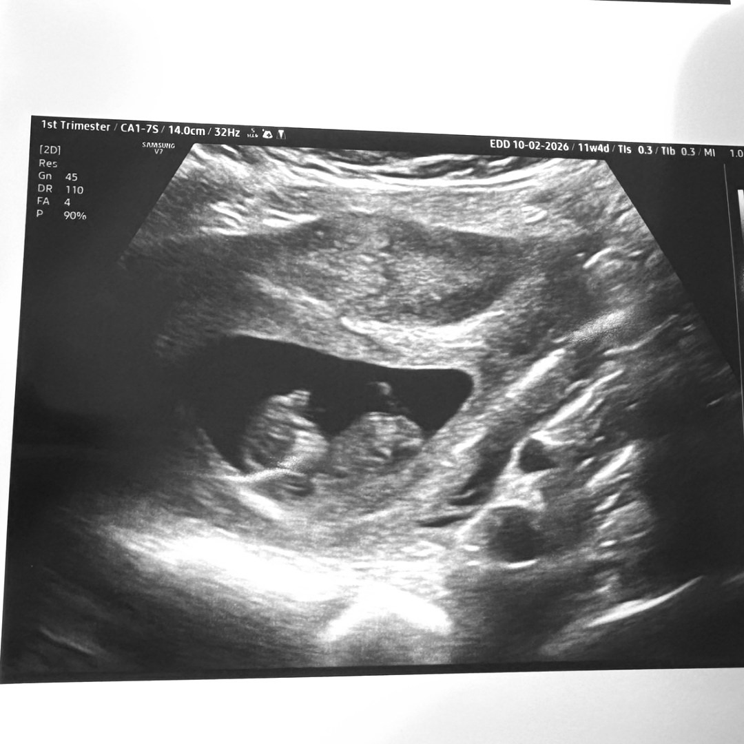 Photo shared by Julissa for their Babylist baby registry.