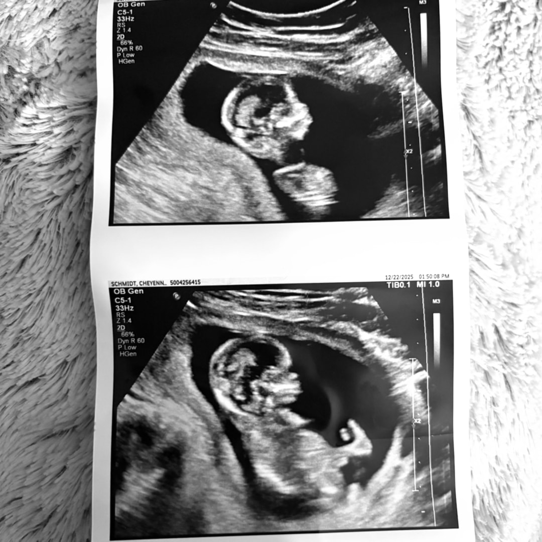 Photo shared by Chey for their Babylist baby registry.