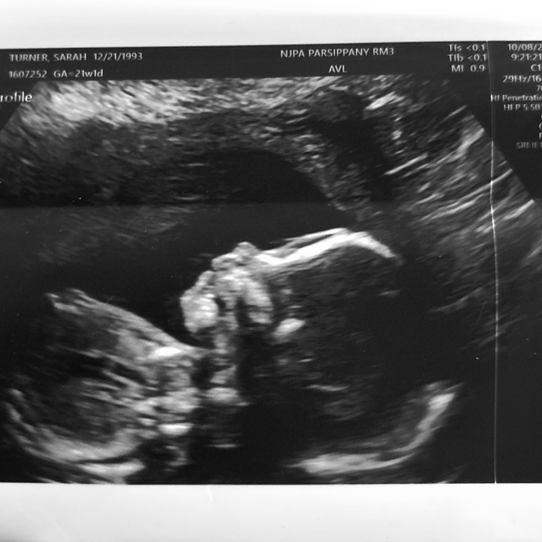 Photo shared by Sarah for their Babylist baby registry.