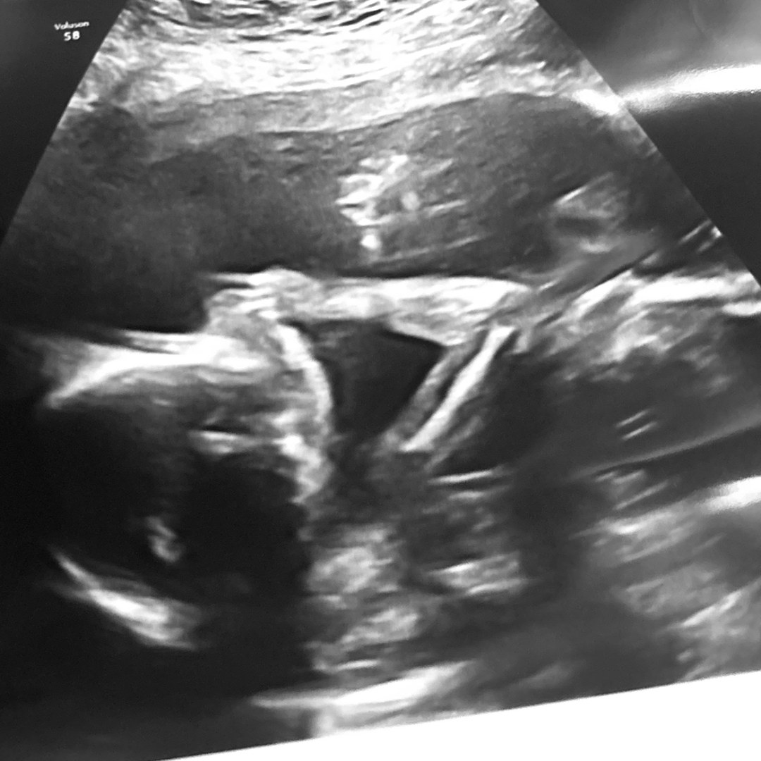 Photo shared by Abby for their Babylist baby registry.