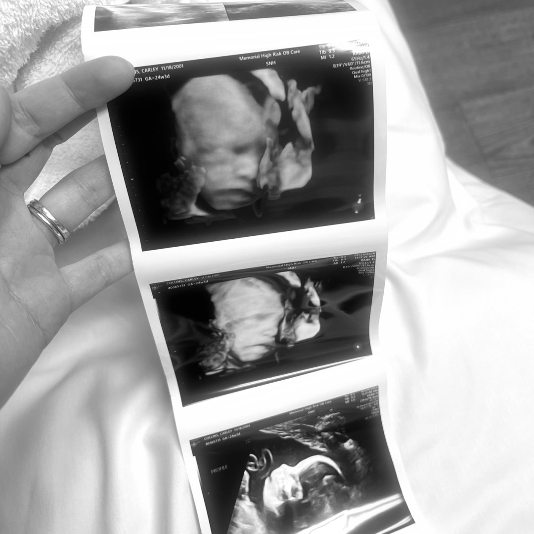 Photo shared by Carley for their Babylist baby registry.