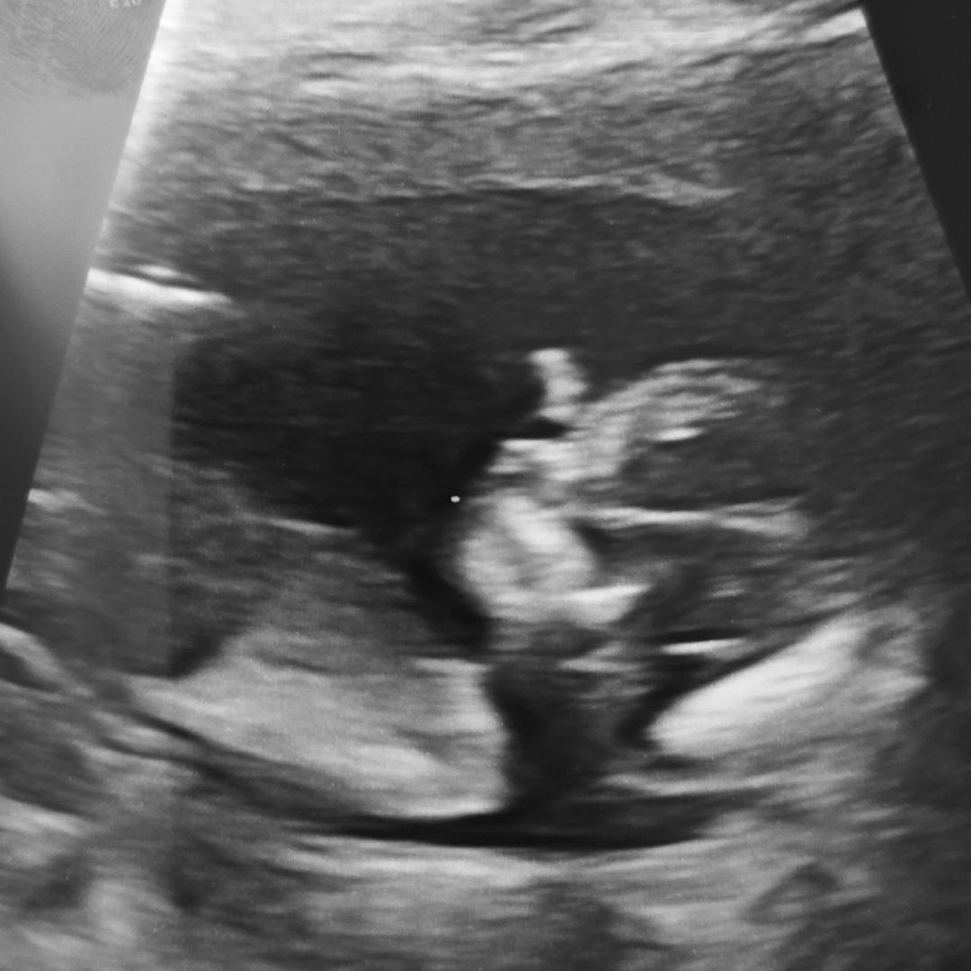Photo shared by Elizabeth for their Babylist baby registry.
