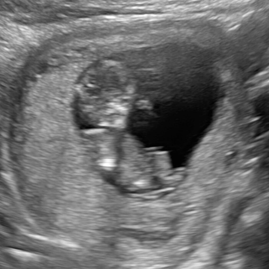 Photo shared by Alanna for their Babylist baby registry.