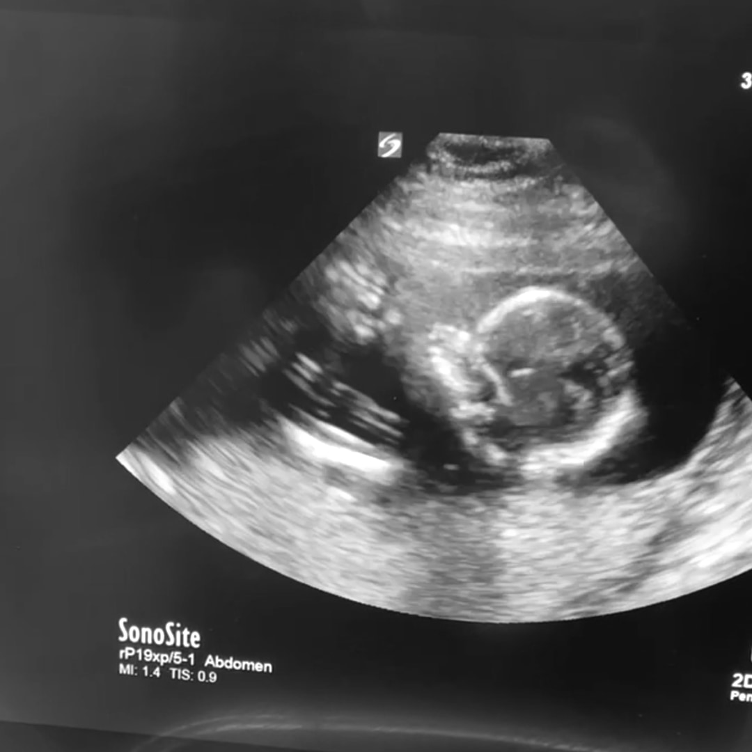 Photo shared by Chalyn for their Babylist baby registry.