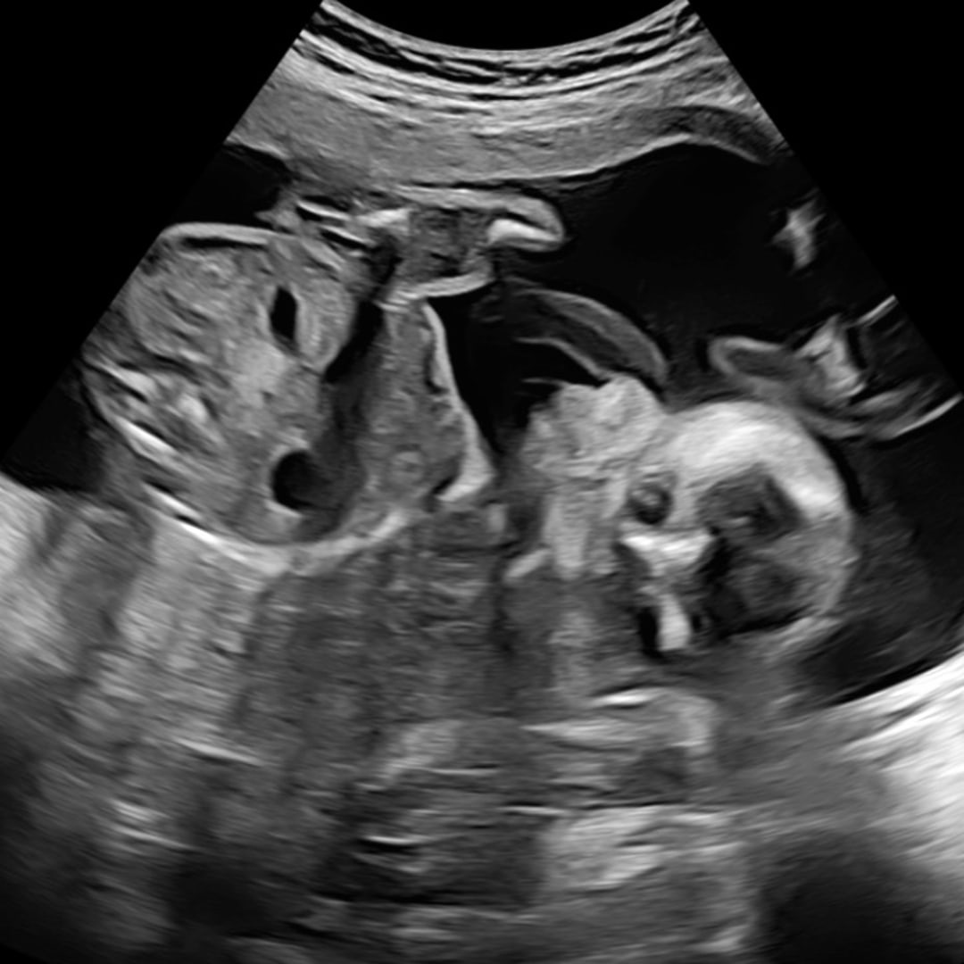 Photo shared by Alaina for their Babylist baby registry.