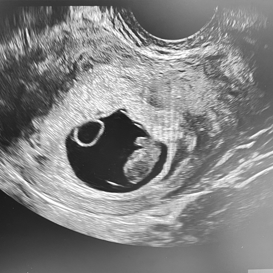 Photo shared by Alicia for their Babylist baby registry.