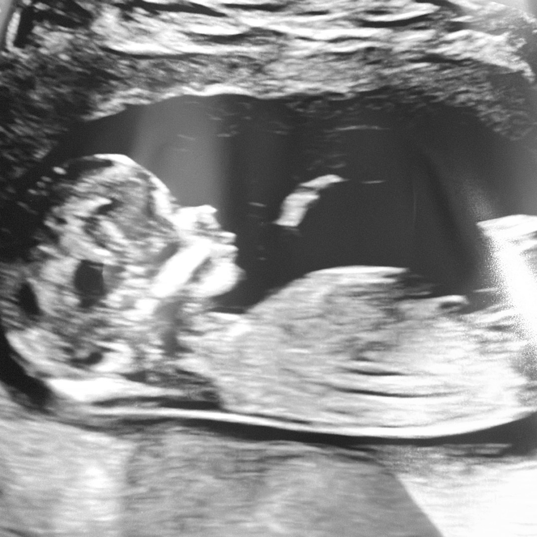 Photo shared by Adrienne for their Babylist baby registry.