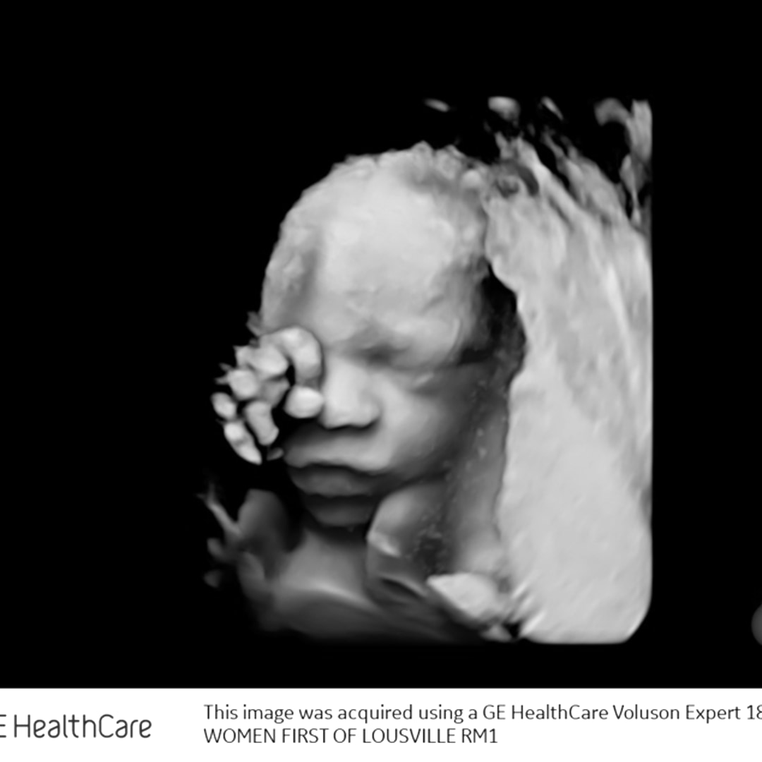 Photo shared by Maggie for their Babylist baby registry.